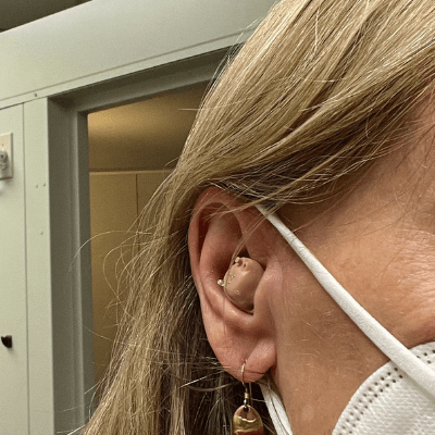 A CIC hearing aid that doesn't fit